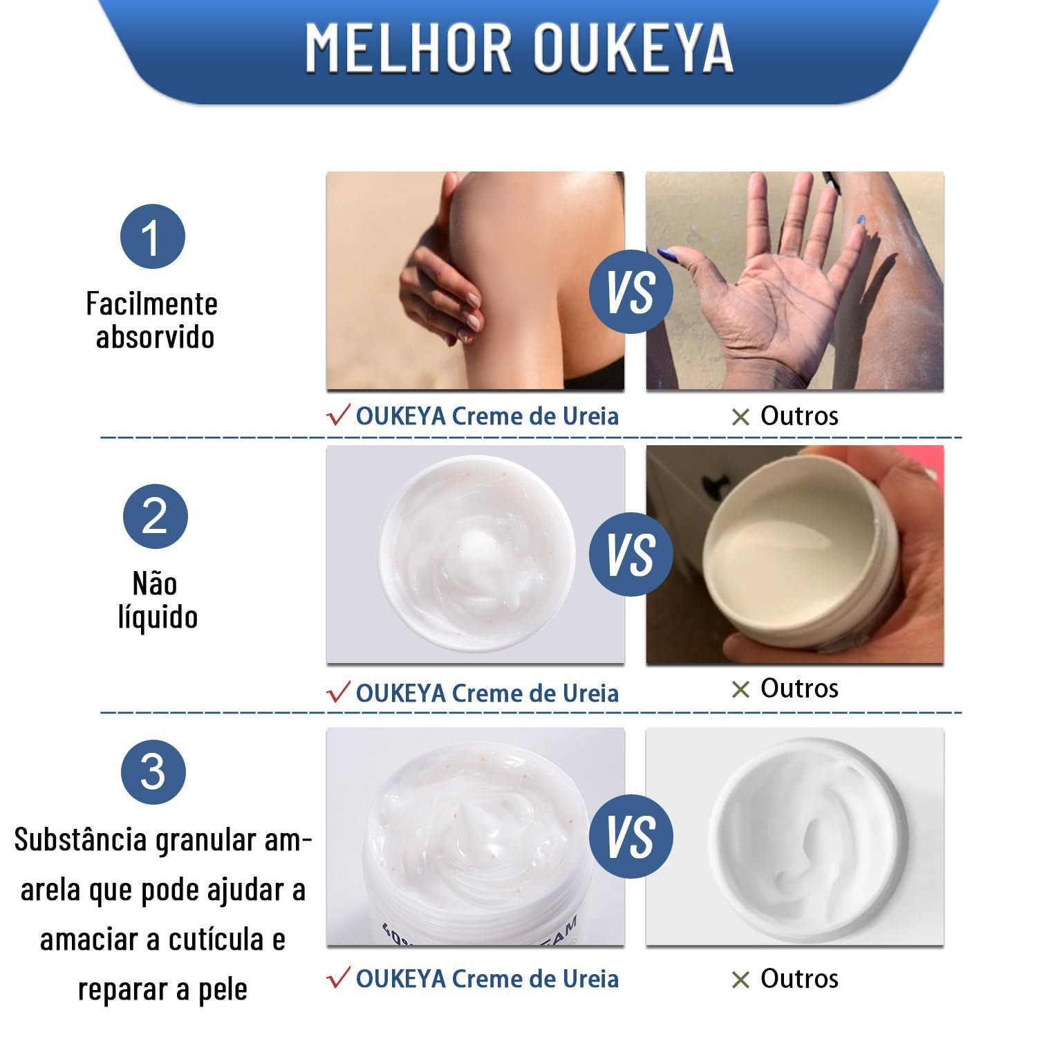 Urea Moisturizing Hand Foot Cream